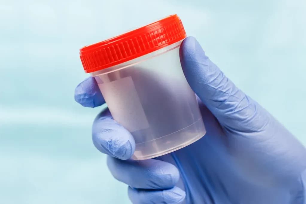 Jak przygotować się do badania moczu, aby uniknąć błędów i stresu