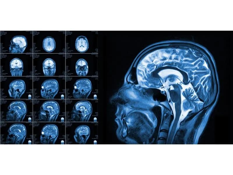 Czy lekarz rodzinny może wystawić skierowanie na rezonans magnetyczny?