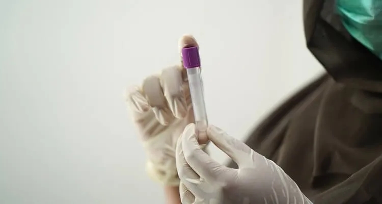 Ile kału do badania? Sprawdź, aby uniknąć błędów w diagnostyce