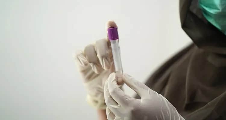 Ile kału do badania? Sprawdź, aby uniknąć błędów w diagnostyce