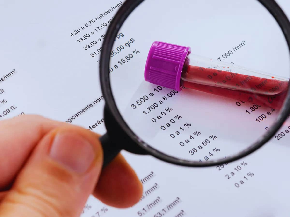 Co to jest IG w badaniu krwi i dlaczego może być niebezpieczne?