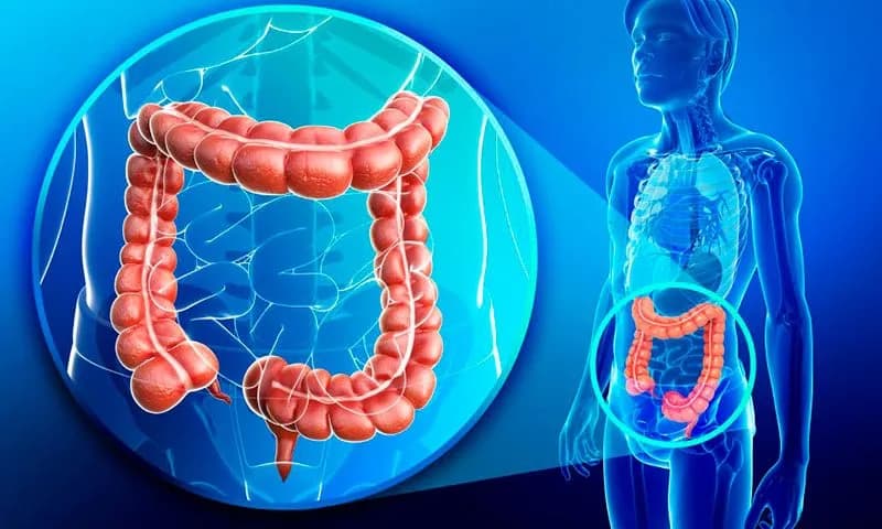 Jaki lekarz leczy hemoroidy? Oto specjalista, którego potrzebujesz
