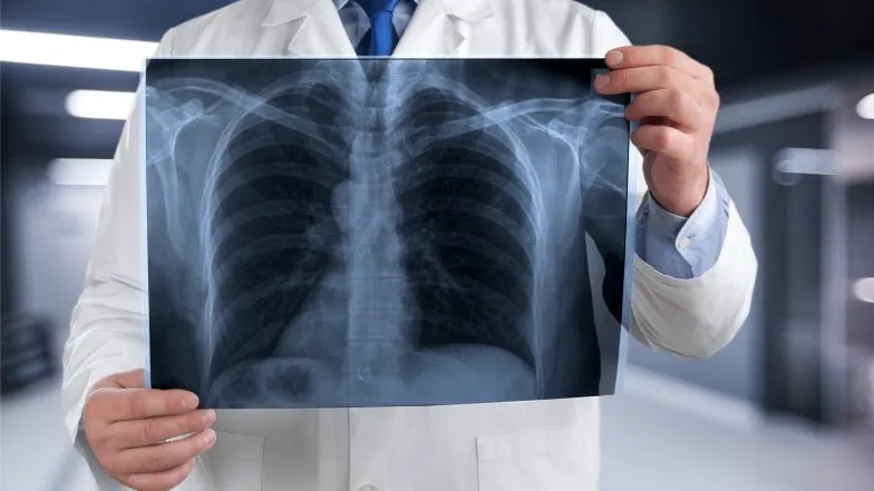 Jakie badania są kluczowe w diagnostyce raka płuc i dlaczego?